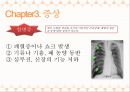 폐렴(PNEUMONIA) - 정의, 원인, 종류, 증상, 진료 및 치료, 예방방법.pptx 15페이지