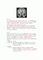 만성 경막하 출혈 (Chronic Subdural Hemorrhage) 케이스 스터디 CASE STUDY - 수술명 : burr hole trephination and SDH removal 5페이지