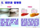 [생활과 건강] 비만 - 비만의 정의, 비만의 종류, 비만의 원인, 비만의 증상, 비만의 합병증, 비만의 치료 등에 관해.pptx 7페이지
