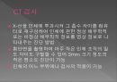 [간호] CT검사 2페이지