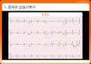 임상표현종합토의 - 흉통(chest pain) {환자의 입원기록지, 환자평가를 통한 진단 가설, 진단 및 병태생리, 치료}.pptx 7페이지