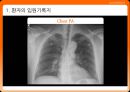 임상표현종합토의 - 흉통(chest pain) {환자의 입원기록지, 환자평가를 통한 진단 가설, 진단 및 병태생리, 치료}.pptx 8페이지