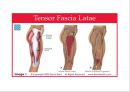 04. 다리 근육 (Leg muscle) - 1 의 기시, 정지 , 작용 , TP사진, 기능적 단위 등.pptx 4페이지