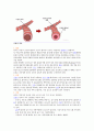 정형외과 케이스 스터디 OS case study (Femur neck fracture) 4페이지
