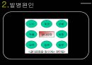골다공증.ppt 10페이지