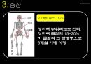 골다공증.ppt 14페이지