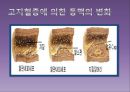 고지혈증과 심혈관계 질환.pptx 7페이지