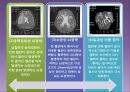 고지혈증과 심혈관계 질환.pptx 42페이지