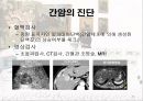 암과 관절염 {간암, 대장암, 위암, 폐암, 유방암}.pptx 12페이지