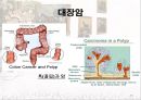 암과 관절염 {간암, 대장암, 위암, 폐암, 유방암}.pptx 18페이지