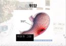 암과 관절염 {간암, 대장암, 위암, 폐암, 유방암}.pptx 27페이지