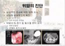 암과 관절염 {간암, 대장암, 위암, 폐암, 유방암}.pptx 34페이지