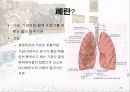 암과 관절염 {간암, 대장암, 위암, 폐암, 유방암}.pptx 40페이지