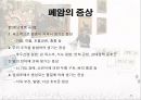 암과 관절염 {간암, 대장암, 위암, 폐암, 유방암}.pptx 43페이지