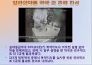 ★[의약품 슈퍼 판매] 단순의약품 슈퍼 판매의 문제점, 단순의약품의 개념, 단순의약품 문제점, 단순의약품 슈퍼 판매 논의 전망.pptx 12페이지