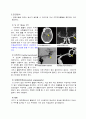 지주막하출혈 신경외과 케이스 스터디 Case Study - 병명 : Acute Subarachnoid Hemorrahage  | 주 증상: Headache 4페이지