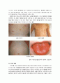 [아동간호학 兒童看護學] 영유아기의 건강문제 시 나타나는 일반적인 증상 - 전신 증상, 호흡기계 이상, 안면부 증상, 피부의 증상 12페이지