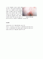 [아동간호학 兒童看護學] 영유아기의 건강문제 시 나타나는 일반적인 증상 - 전신 증상, 호흡기계 이상, 안면부 증상, 피부의 증상 13페이지