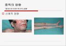 [성인成人의 다양한 중독] 중독의 개념, 중독의 원인, 성인기 중독의 심각성, 성인 중독 문제점, 중독 치료 방안 18페이지