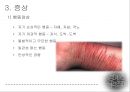 ★★평가우수자료★★[경계선 성격 장애의 치료] 경계선 사이에서의 끝없는 헤메임 - 경계선 성격 장애 개념, 경계선 성격 장애 원인, 경계선 성격 장애 증상, 경계선 성격 장애 문제점과 치료방법.pptx 21페이지