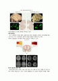 [노인간호학 실습] 치매 dementia 케이스 스터디 Case Study 5페이지