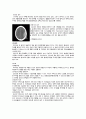 문헌고찰 NCU 경막외 혈종(epidural hematoma) [문헌고찰] 2페이지