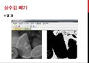 영상처리 - 포인트 처리.pptx 7페이지