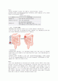Ascending colon cancer 상행결장암 - 상행결장에 발생하는 악성 종양. 결장암의 98%는 adenocarcinoma이다. 3페이지