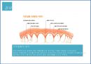 [인간질병과 건강한 삶]치주질환의 정의와 예방법 - 치주질환 개념, 치주질환 원인, 치주질환 사례, 치주질환 예방.pptx 3페이지