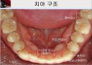 [치주질환 (periodontal disease)] 치주질환 정의, 치주질환 종류, 치주질환 원인, 치주질환 증상, 치주질환 치료.ppt 3페이지