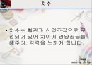 [치주질환 (periodontal disease)] 치주질환 정의, 치주질환 종류, 치주질환 원인, 치주질환 증상, 치주질환 치료.ppt 8페이지