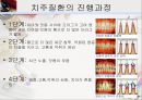 [치주질환 (periodontal disease)] 치주질환 정의, 치주질환 종류, 치주질환 원인, 치주질환 증상, 치주질환 치료.ppt 21페이지