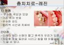 [치주질환 (periodontal disease)] 치주질환 정의, 치주질환 종류, 치주질환 원인, 치주질환 증상, 치주질환 치료.ppt 27페이지