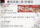 [치주질환 (periodontal disease)] 치주질환 정의, 치주질환 종류, 치주질환 원인, 치주질환 증상, 치주질환 치료.ppt 28페이지