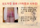 [★발표자료★][변태성욕] 성도착증 - 성도착증의 개념(정의), 성도착증 종류, 다양한 성 도착증.ppt 11페이지