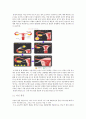 [불임의 원인과 치료] 불임 (不姙) - 불임의 개념, 불임 검사, 불임 원인, 불임 치료방법 6페이지