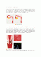 [불임의 원인과 치료] 불임 (不姙) - 불임의 개념, 불임 검사, 불임 원인, 불임 치료방법 8페이지