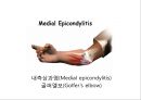 Elbow & Wrist & Finger 팔꿈치 & 손 수술 방법의 이해.pptx 42페이지