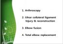 Elbow & Wrist & Finger 팔꿈치 & 손 수술 방법의 이해.pptx 45페이지