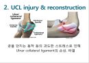Elbow & Wrist & Finger 팔꿈치 & 손 수술 방법의 이해.pptx 47페이지
