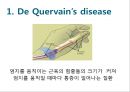 Elbow & Wrist & Finger 팔꿈치 & 손 수술 방법의 이해.pptx 55페이지