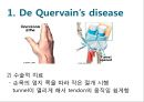 Elbow & Wrist & Finger 팔꿈치 & 손 수술 방법의 이해.pptx 57페이지