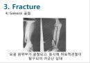 Elbow & Wrist & Finger 팔꿈치 & 손 수술 방법의 이해.pptx 68페이지