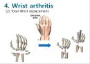 Elbow & Wrist & Finger 팔꿈치 & 손 수술 방법의 이해.pptx 74페이지