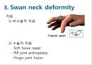 Elbow & Wrist & Finger 팔꿈치 & 손 수술 방법의 이해.pptx 84페이지