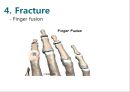 Elbow & Wrist & Finger 팔꿈치 & 손 수술 방법의 이해.pptx 91페이지