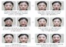 안면마비 (Facial palsy) 근골격 재활 운동 학회.pptx 21페이지