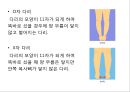 0 & X 다리의 이해 및 운동運動 방법 2페이지