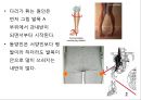 0 & X 다리의 이해 및 운동運動 방법 23페이지
