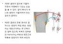 0 & X 다리의 이해 및 운동運動 방법 25페이지